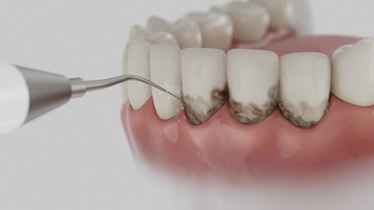 Reliable Dental Implants contractor in Edina, MN by Smile Center Dentistry